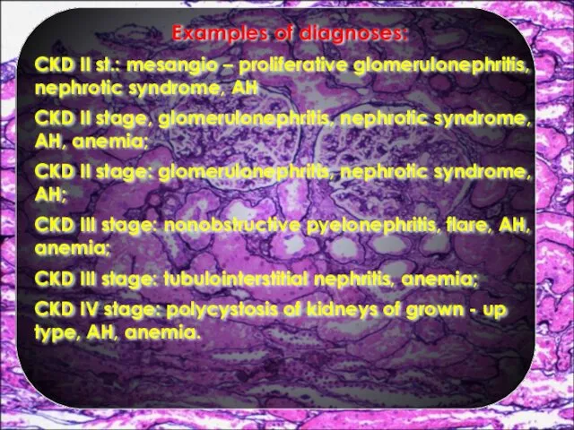 Examples of diagnoses: CKD II st.: mesangio – proliferative glomerulonephritis, nephrotic