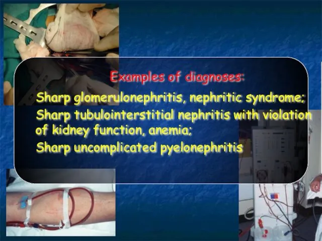 Examples of diagnoses: Sharp glomerulonephritis, nephritic syndrome; Sharp tubulointerstitial nephritis with