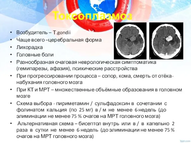 Токсоплазмоз Возбудитель – Т.gondii Чаще всего –церебральная форма Лихорадка Головные боли