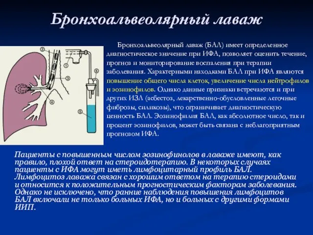 Бронхоальвеолярный лаваж Пациенты с повышенным числом эозинофинолов в лаваже имеют, как