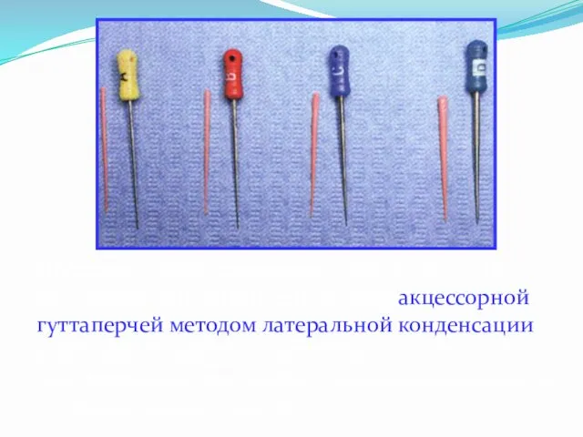 После обтурации корневого канала Thermafil необходимо его доконденсировать акцессорной гуттаперчей методом