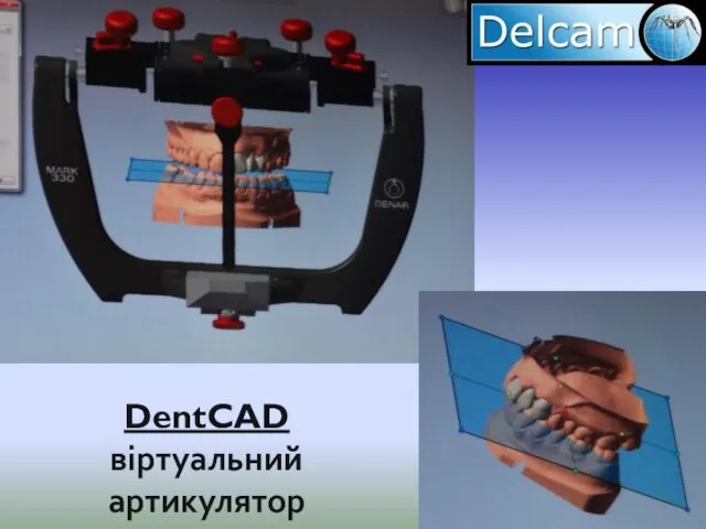 DentCAD віртуальний артикулятор