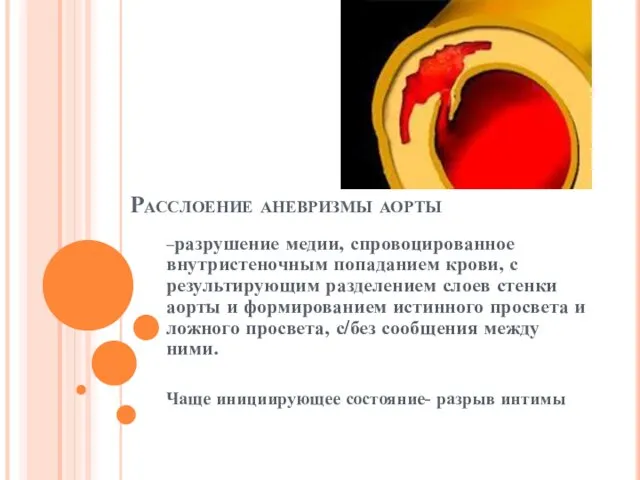 Расслоение аневризмы аорты –разрушение медии, спровоцированное внутристеночным попаданием крови, с результирующим