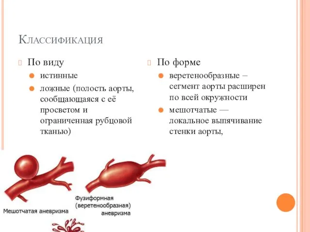 Классификация По виду истинные ложные (полость аорты, сообщающаяся с её просветом