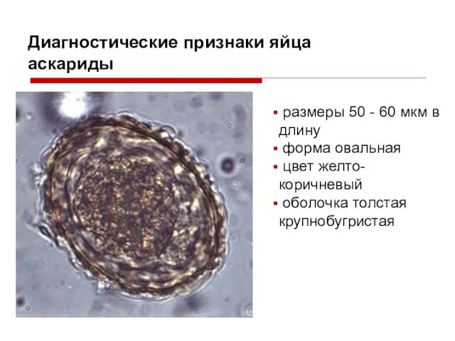 Диагностические признаки яйца аскариды размеры 50 - 60 мкм в длину