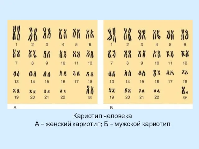 Кариотип человека А – женский кариотип; Б – мужской кариотип