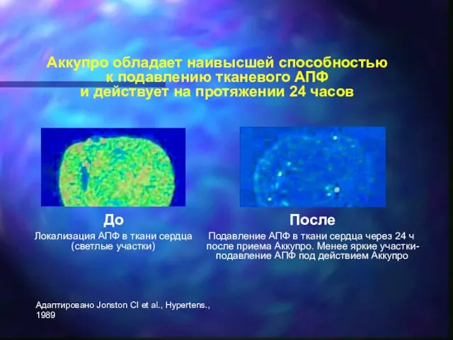 Аккупро обладает наивысшей способностью к подавлению тканевого АПФ и действует на