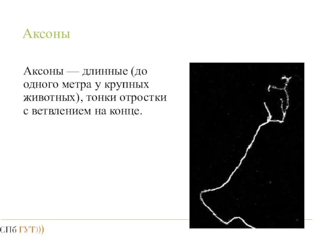 Аксоны Аксоны — длинные (до одного метра у крупных животных), тонки отростки с ветвлением на конце.