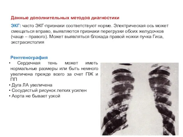 Данные дополнительных методов диагностики ЭКГ: часто ЭКГ-признаки соответствуют норме. Электрическая ось