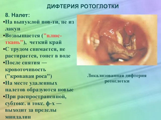 ДИФТЕРИЯ РОТОГЛОТКИ 8. Налет: На выпуклой пов-ти, не из лакун Возвышается