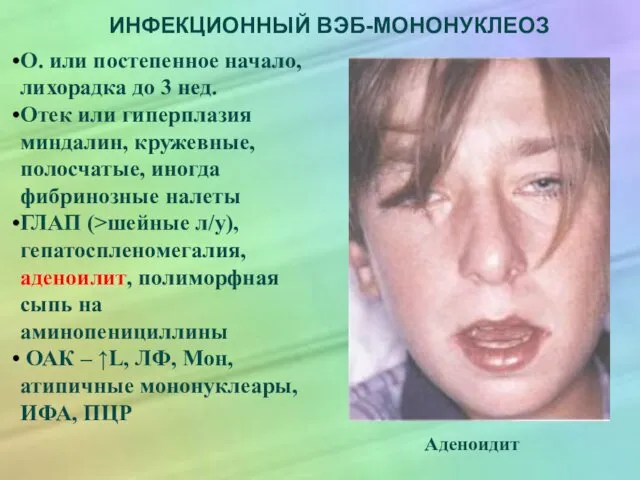 ИНФЕКЦИОННЫЙ ВЭБ-МОНОНУКЛЕОЗ О. или постепенное начало, лихорадка до 3 нед. Отек