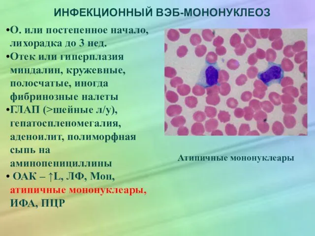 ИНФЕКЦИОННЫЙ ВЭБ-МОНОНУКЛЕОЗ О. или постепенное начало, лихорадка до 3 нед. Отек