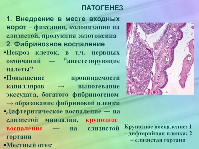 ПАТОГЕНЕЗ 1. Внедрение в месте входных ворот – фиксация, колонизация на