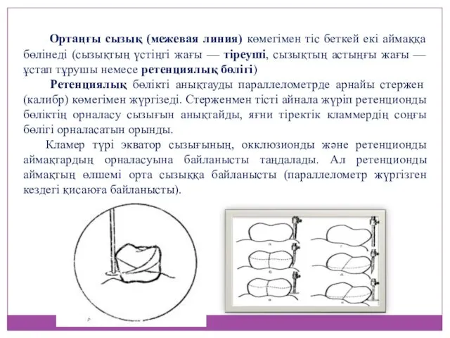 Ортаңғы сызық (межевая линия) көмегімен тіс беткей екі аймаққа бөлінеді (сызықтың