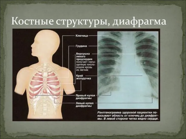 Костные структуры, диафрагма