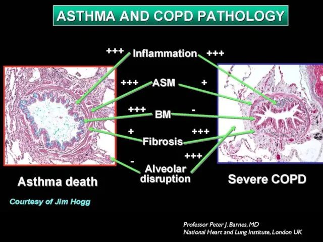 Professor Peter J. Barnes, MD National Heart and Lung Institute, London UK