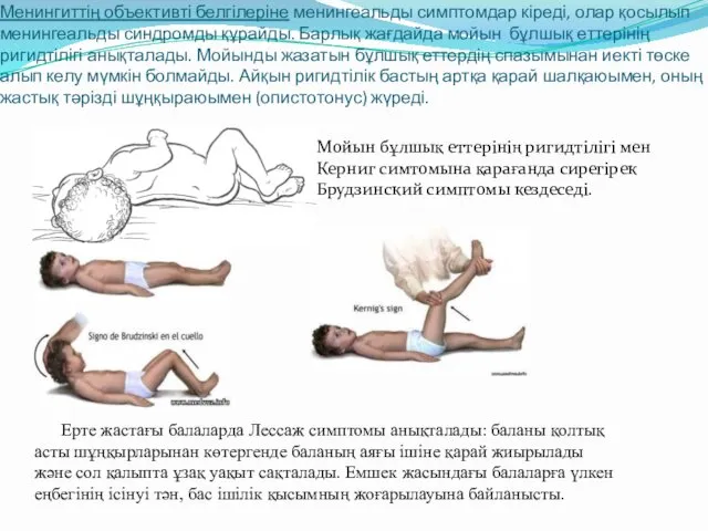 Менингиттің объективті белгілеріне менингеальды симптомдар кіреді, олар қосылып менингеальды синдромды құрайды.