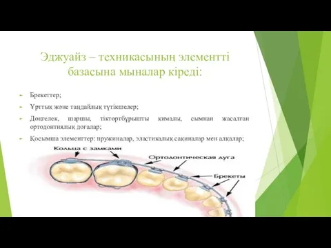 Эджуайз – техникасының элементті базасына мыналар кіреді: Брекеттер; Ұрттық және таңдайлық