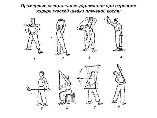 Примерные специальные упражнения при переломе хирургической шейки плечевой кости