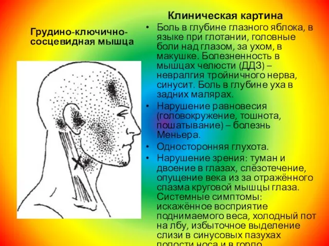 Грудино-ключично-сосцевидная мышца Клиническая картина Боль в глубине глазного яблока, в языке