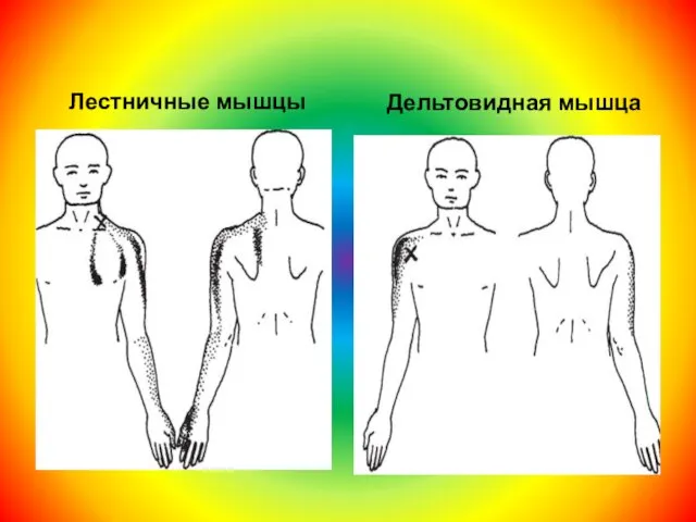 Лестничные мышцы Дельтовидная мышца