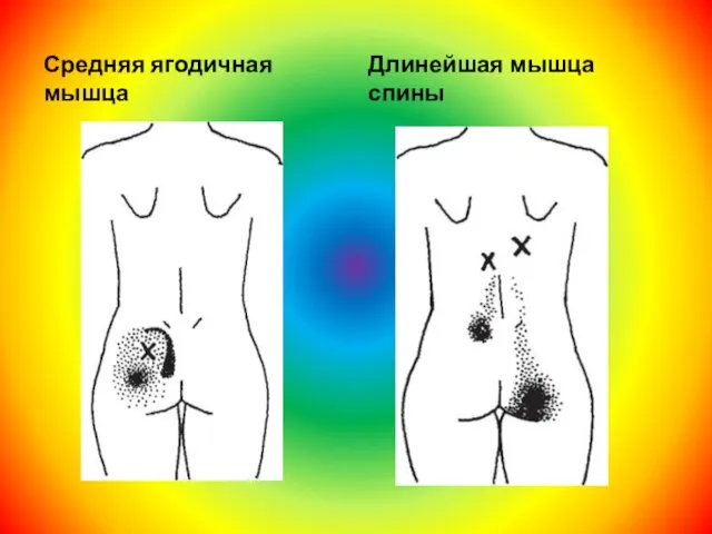 Средняя ягодичная мышца Длинейшая мышца спины