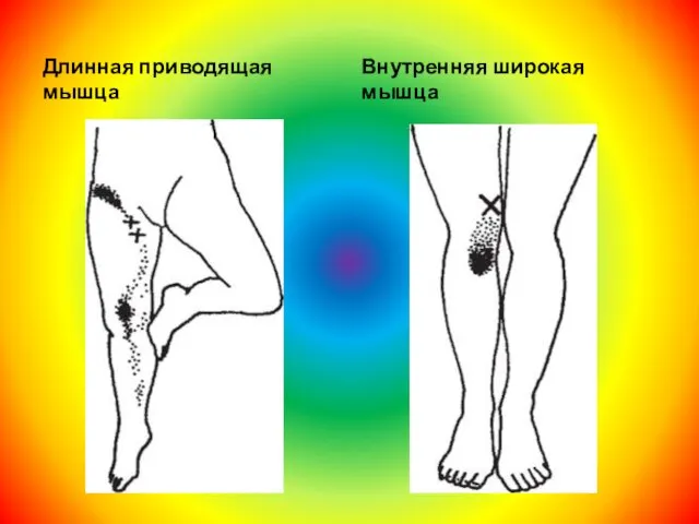 Длинная приводящая мышца Внутренняя широкая мышца