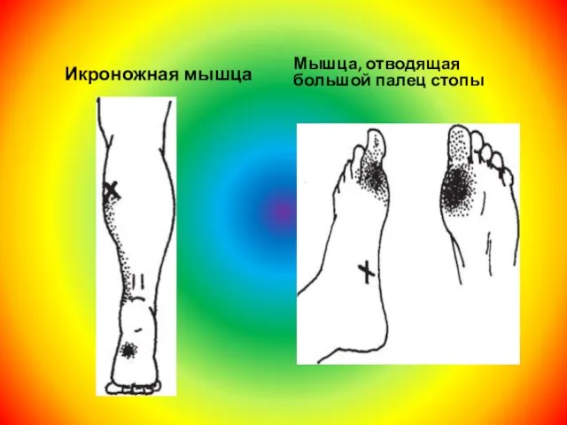 Икроножная мышца Мышца, отводящая большой палец стопы