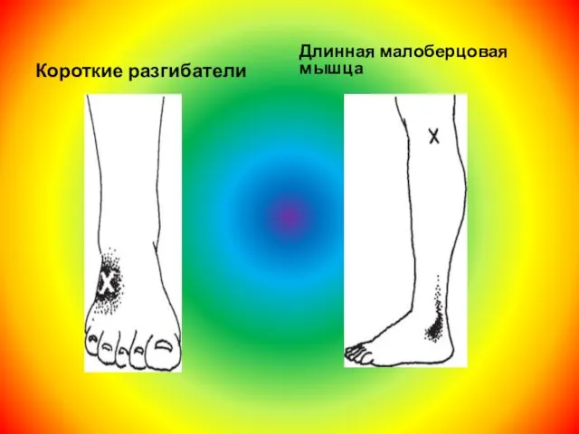 Короткие разгибатели Длинная малоберцовая мышца