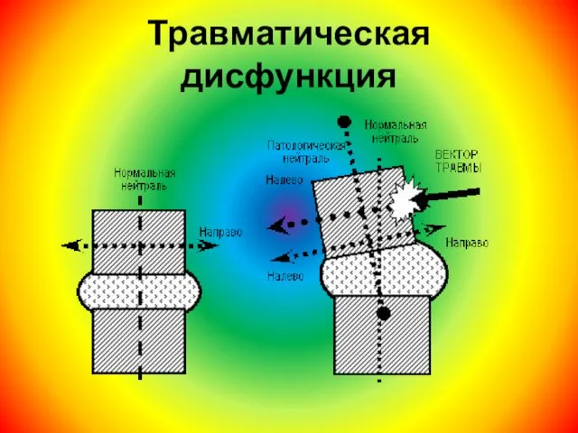 Травматическая дисфункция