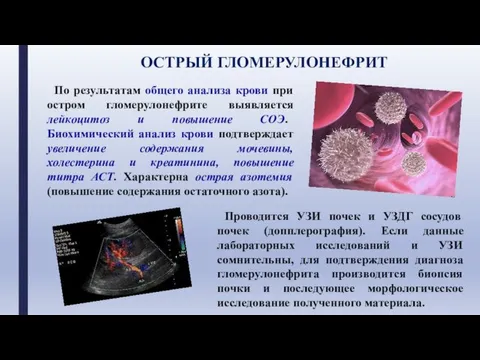 По результатам общего анализа крови при остром гломерулонефрите выявляется лейкоцитоз и