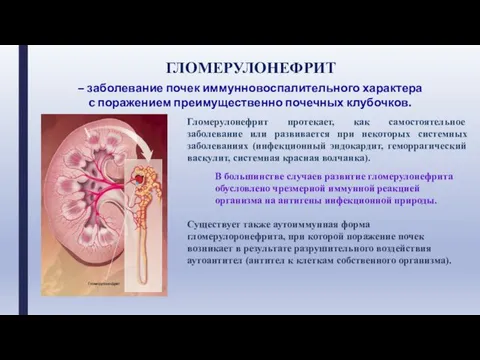 ГЛОМЕРУЛОНЕФРИТ – заболевание почек иммунновоспалительного характера c поражением преимущественно почечных клубочков.