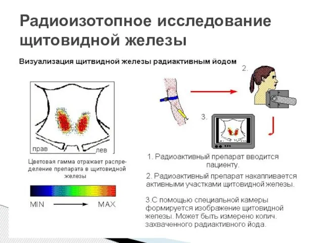 Радиоизотопное исследование щитовидной железы