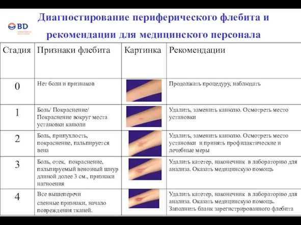 Диагностирование периферического флебита и рекомендации для медицинского персонала