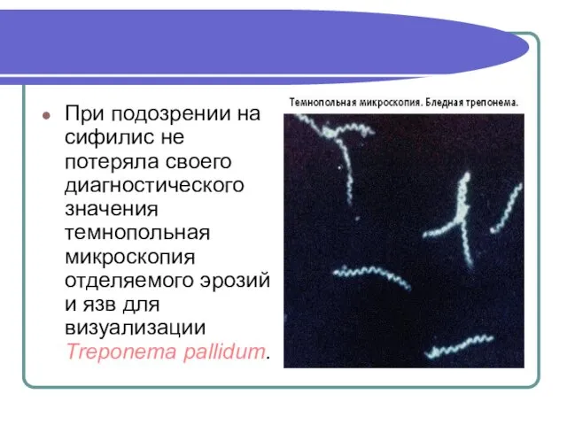 При подозрении на сифилис не потеряла своего диагностического значения темнопольная микроскопия