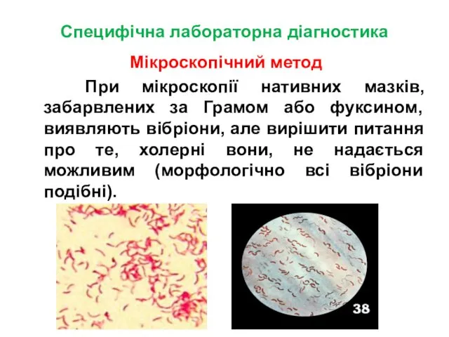 Специфічна лабораторна діагностика Мікроскопічний метод При мікроскопії нативних мазків, забарвлених за