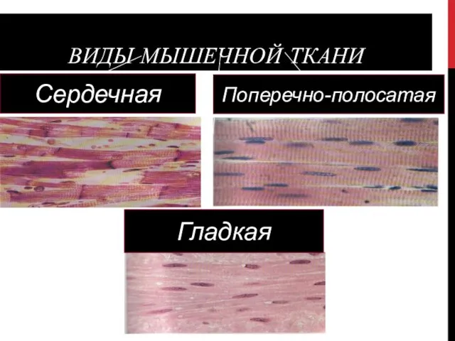 ВИДЫ МЫШЕЧНОЙ ТКАНИ Сердечная Гладкая Поперечно-полосатая