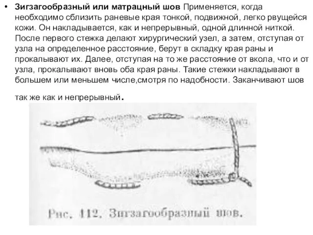 Зигзагообразный или матрацный шов Применяется, когда необходимо сблизить раневые края тонкой,