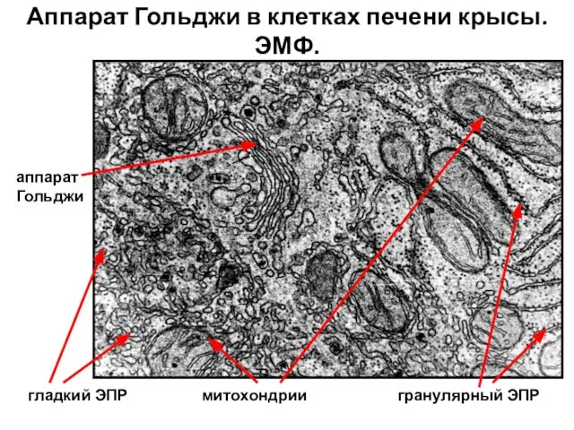 Аппарат Гольджи в клетках печени крысы. ЭМФ. аппарат Гольджи гранулярный ЭПР митохондрии гладкий ЭПР