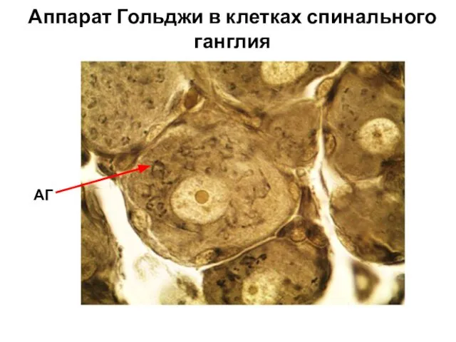 Аппарат Гольджи в клетках спинального ганглия АГ