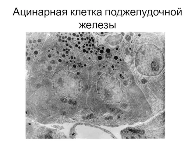 Ацинарная клетка поджелудочной железы