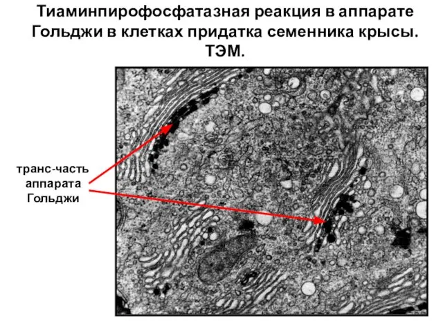Тиаминпирофосфатазная реакция в аппарате Гольджи в клетках придатка семенника крысы. ТЭМ. транс-часть аппарата Гольджи