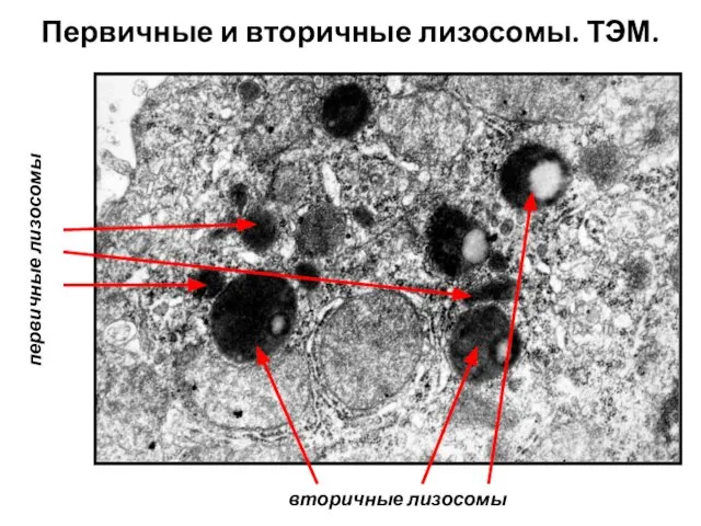 Первичные и вторичные лизосомы. ТЭМ. первичные лизосомы вторичные лизосомы