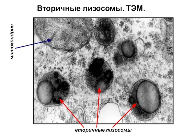 Вторичные лизосомы. ТЭМ. вторичные лизосомы митохондрия