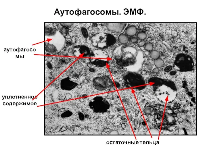 Аутофагосомы. ЭМФ. остаточные тельца аутофагосомы уплотненное содержимое