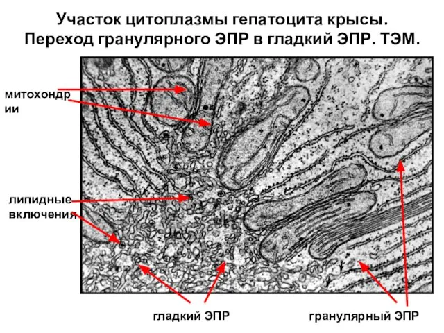 Участок цитоплазмы гепатоцита крысы. Переход гранулярного ЭПР в гладкий ЭПР. ТЭМ.