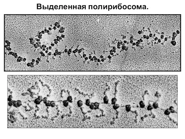 Выделенная полирибосома.