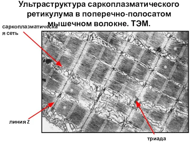 Ультраструктура саркоплазматического ретикулума в поперечно-полосатом мышечном волокне. ТЭМ. саркоплазматическая сеть триада линия Z