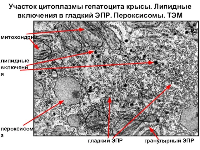 Участок цитоплазмы гепатоцита крысы. Липидные включения в гладкий ЭПР. Пероксисомы. ТЭМ