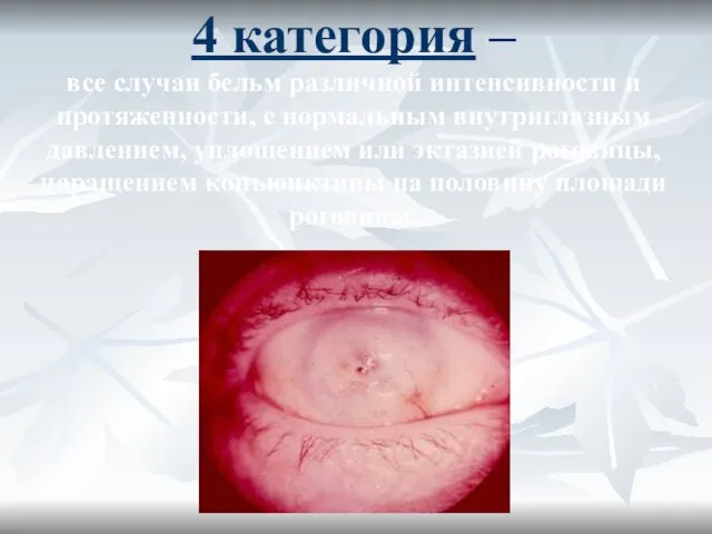 4 категория – все случаи бельм различной интенсивности и протяженности, с